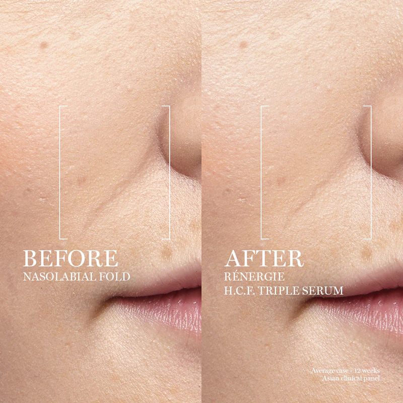 Rénergie H.C.F. Triple Serum - obrazek 3